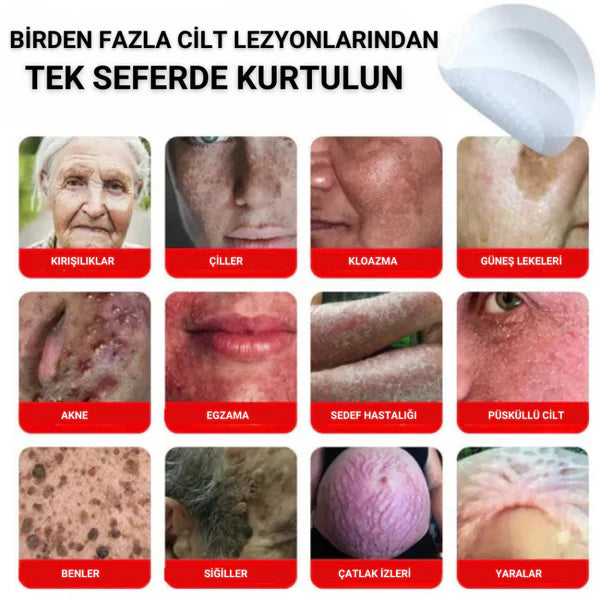 éLoura Mikro İğneli Ben Düşürücü Bant – 5 Günde İz Bırakmadan Düşürür